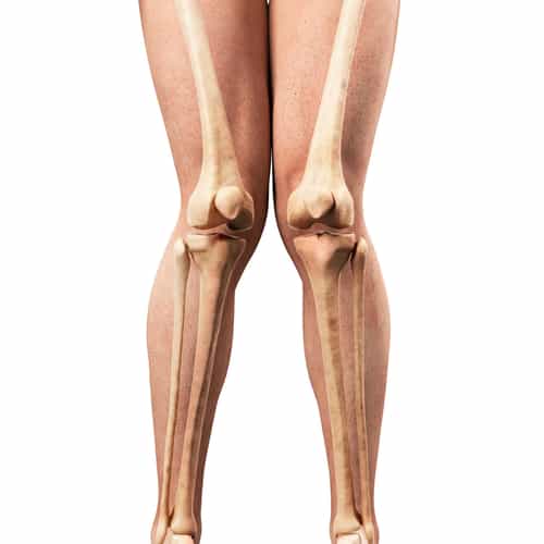 Bow Leg & Knock Knee Correction in Turkey for Nigerians – Transform Your Legs